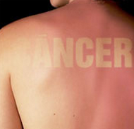 cáncer de piel no melanoma